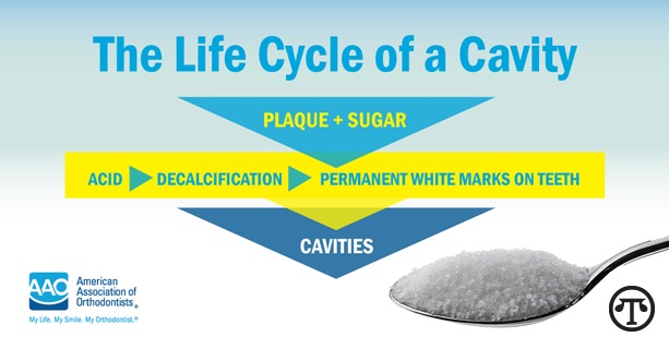 The acid in regular and diet soft drinks can attack and weaken tooth enamel.  