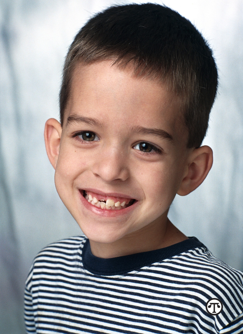 All children should get a check-up with an orthodontist at the first recognition of an orthodontic problem but no later than age seven.