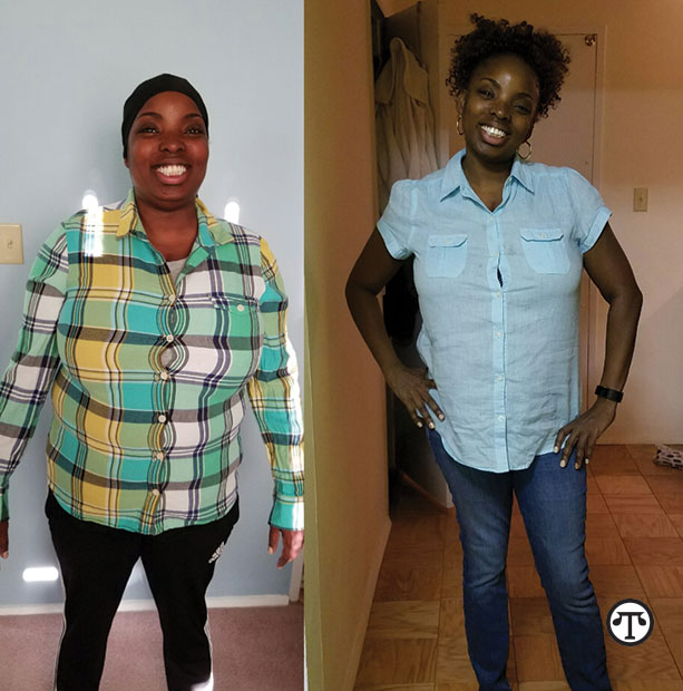 Just six months after having a new kind of weight loss procedure, Guerrant has lost 50 pounds, and can see and feel a difference in her eating habits and her life.